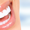 مراقبت از دندان ها بعد از سفیدکردن یا Bleaching