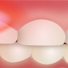 کاربرد و مزایای لیزر در دندانپزشکی